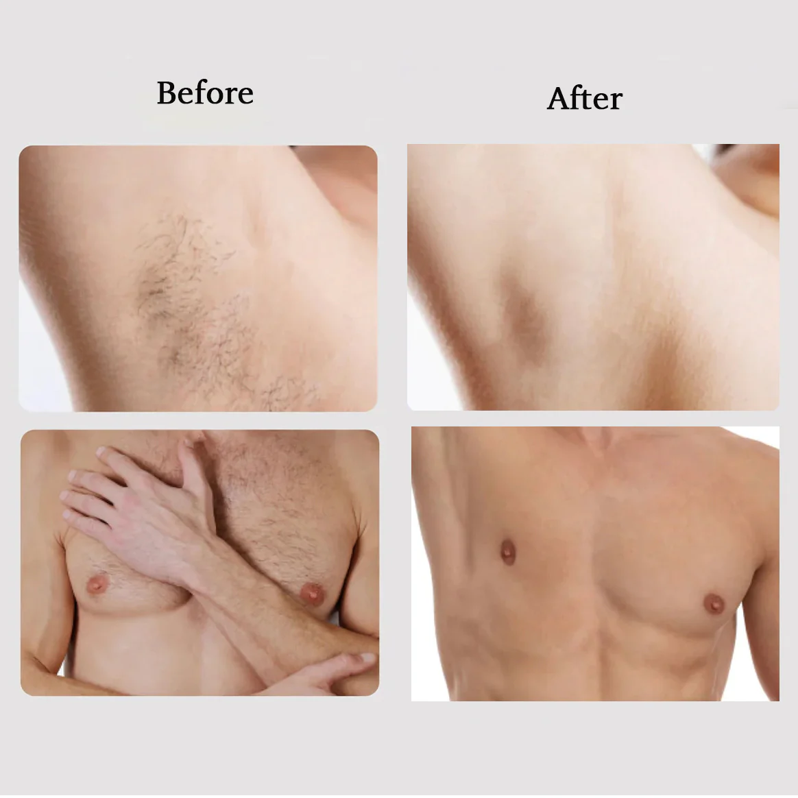 Megelin M1 Sapphire IPL Hair Removal Handset - Image 14
