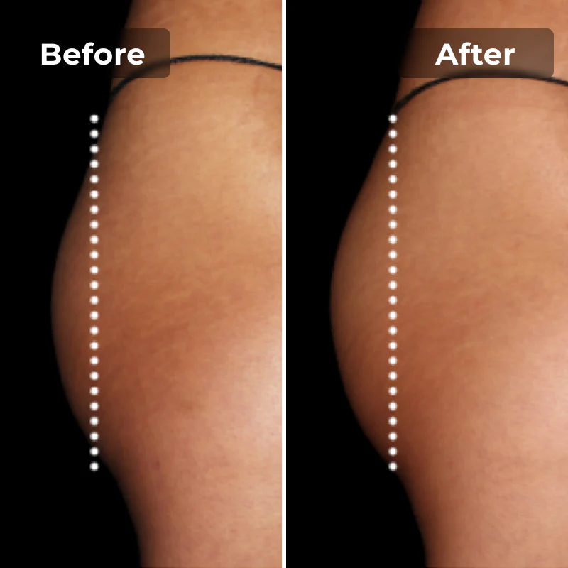 Megelin EMS Toning Shorts - Image 9