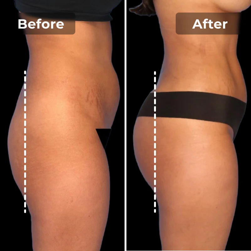 Megelin EMS Toning Shorts - Image 7