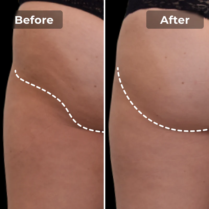 Megelin EMS Toning Shorts - Image 8