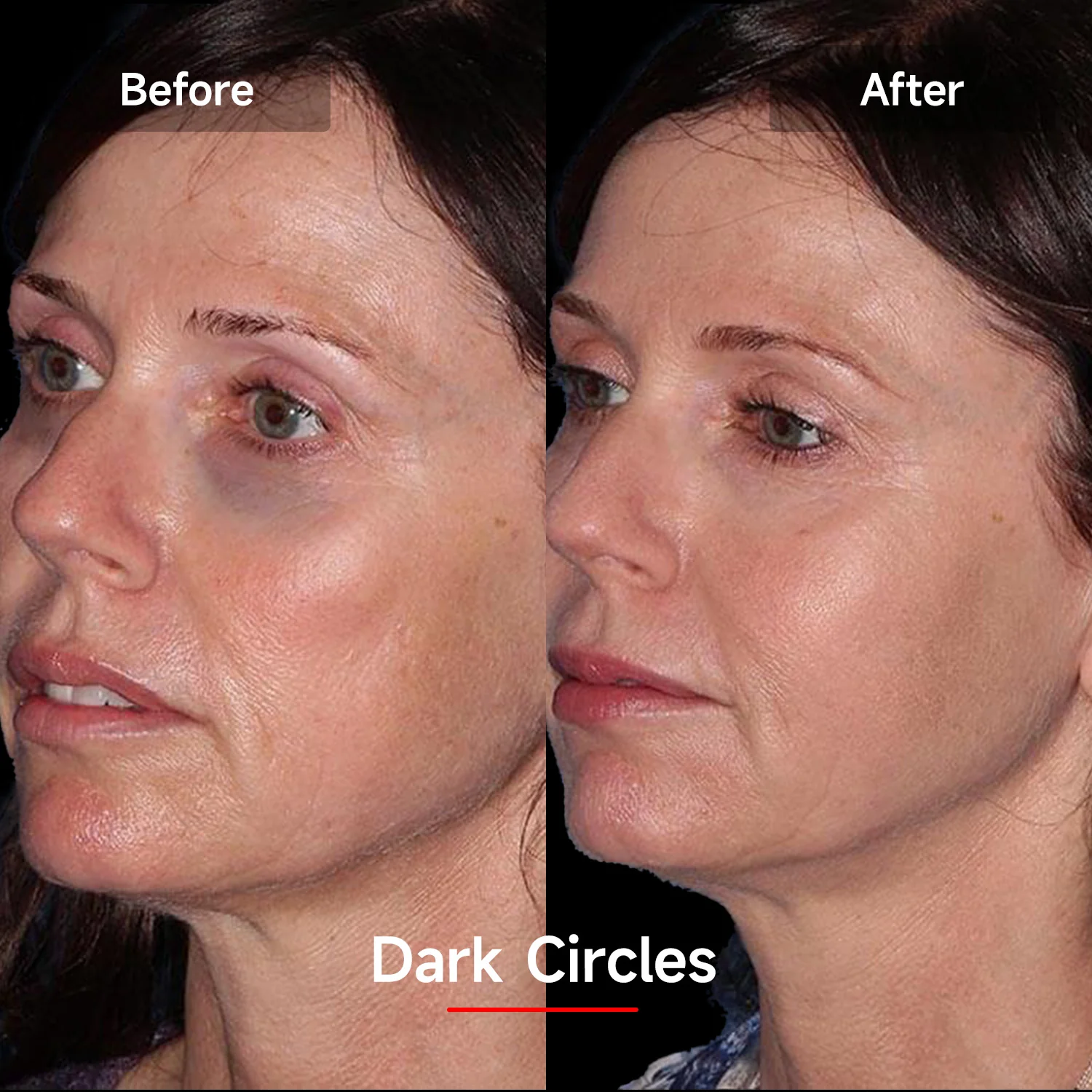 Megelin LASER&LED Light Therapy Mask - Image 15