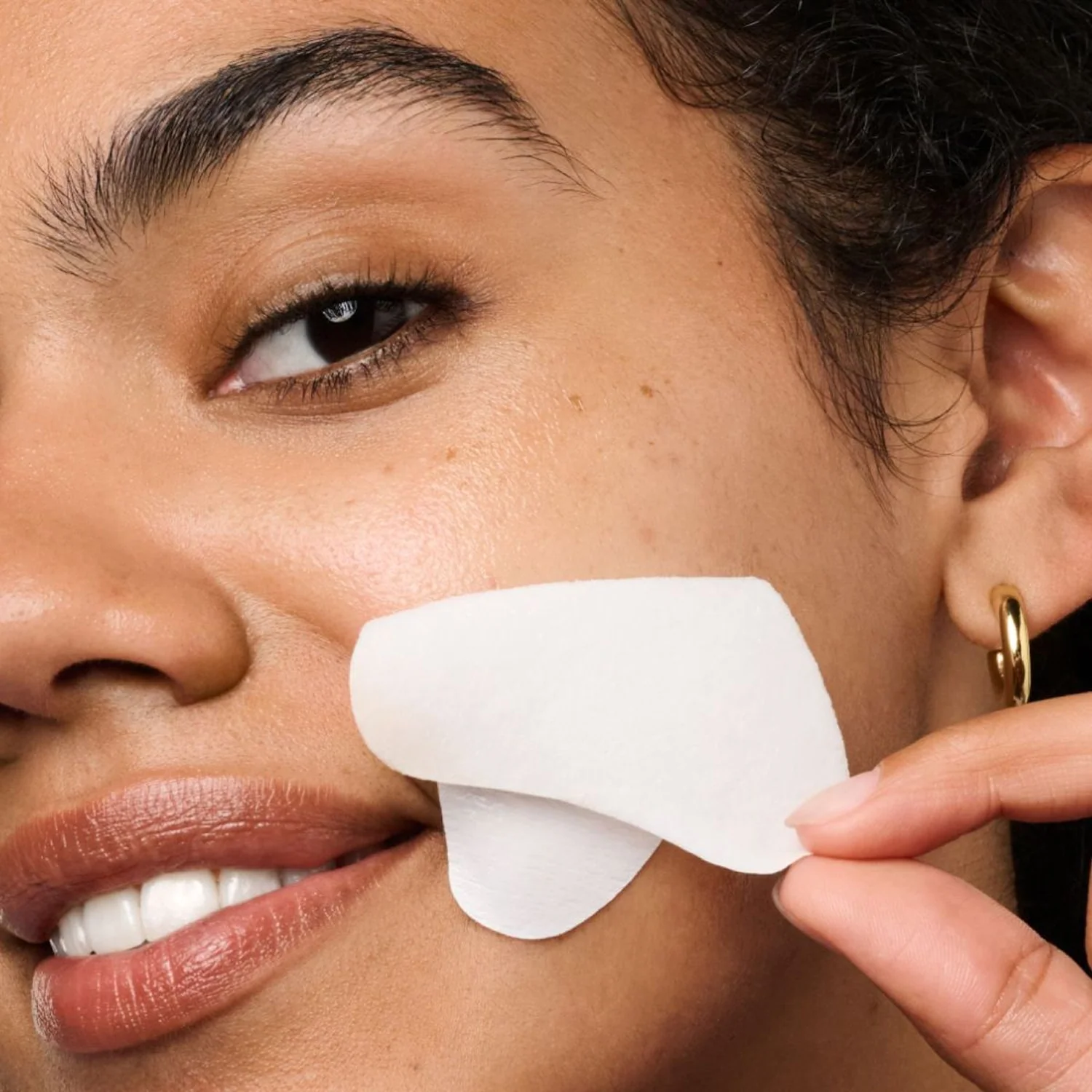Megelin Micro-Infusion Smile Line Patches - Image 5